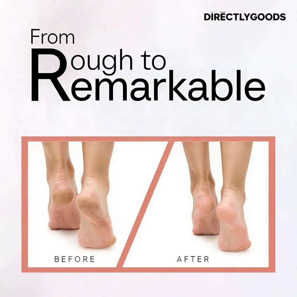 Flawless Pedi Electronic Tool File and Callus Remover, Foot File Callus Remover Tool - Directly Goods